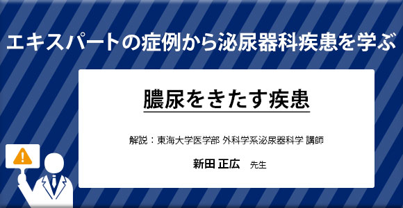 エキスパートの症例から泌尿器科疾患を学ぶ『膿尿をきたす疾患』