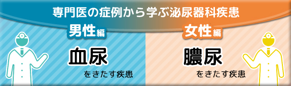 専門医の症例から学ぶ泌尿器科疾患 男性編：血尿をきたす疾患 女性編：膿尿をきたす疾患